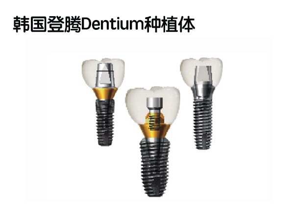 韓國登騰Dentium種植體