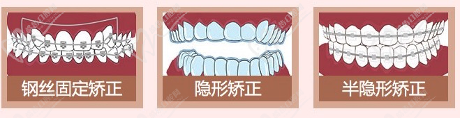 MCOC美奧復(fù)雜病例正畸中心