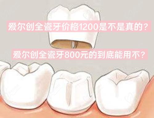 愛爾創(chuàng)全瓷牙價格1200是不是真的