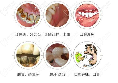 口腔清潔適用情況