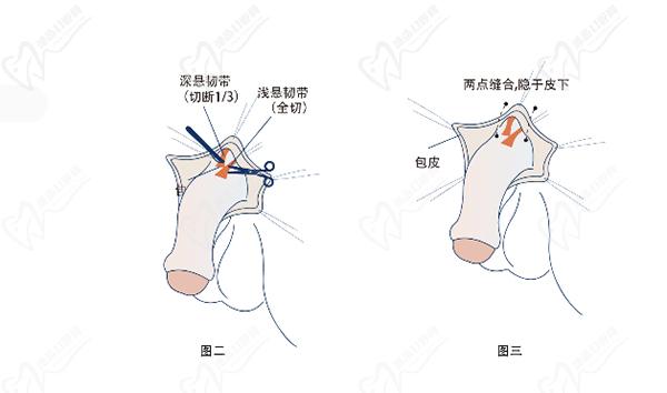 重慶星榮整形醫(yī)院李世榮預約掛號時間