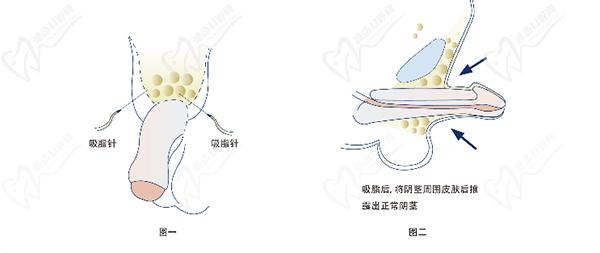 星榮李世榮醫(yī)生費用