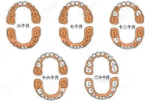 孩子換牙期間要注意什么