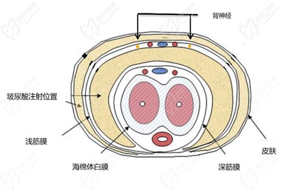 男性生殖整形手術費用大概需要多少錢