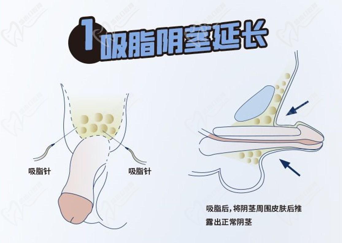 李世榮醫(yī)生很歷害