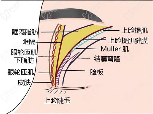 師麗麗修復(fù)雙眼皮怎么樣