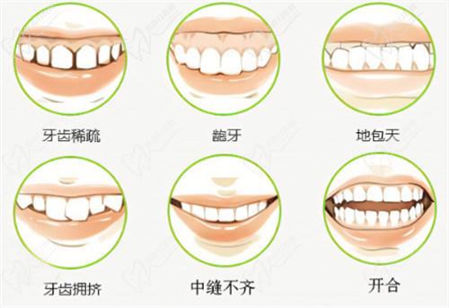 時(shí)代天使隱形矯正官網(wǎng)價(jià)格2025