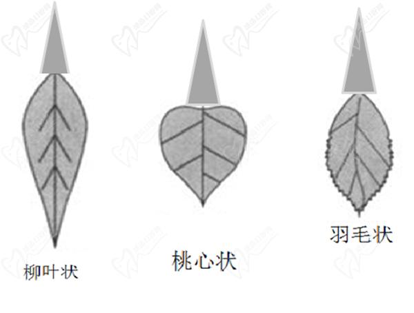 蝴蝶陰部形狀是什么樣