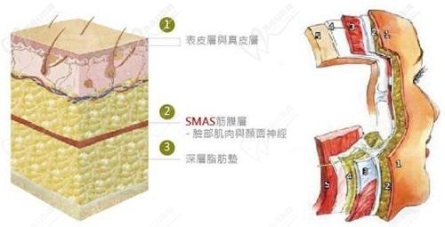 丁昆琨醫(yī)生拉皮手術技術特色
