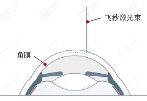 王曉瑛醫(yī)生在哪里出診？上海普瑞、上海和平等眼科醫(yī)院可預(yù)約