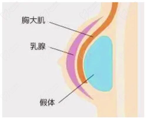 米蘭柏羽開啟胸部醫(yī)生面診日，穆大力、李英大親診做出精致自然美胸