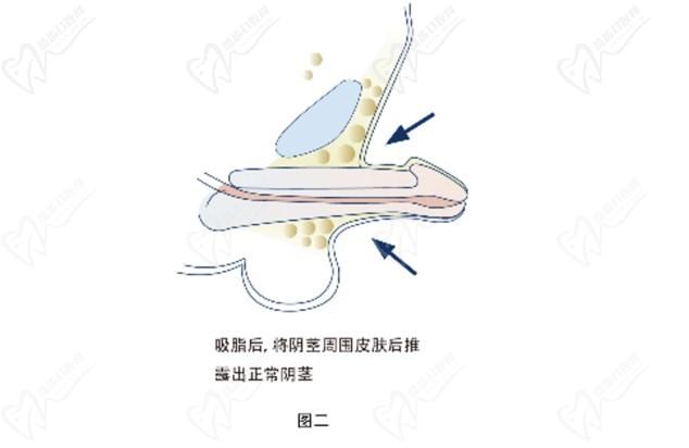 重慶李世榮教授坐診時間及在線預(yù)約開啟！想“變強(qiáng)”做男科手術(shù)找李世榮男性健康管理中心準(zhǔn)沒錯